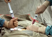 اولین پیوند موفق آلوژن مغز استخوان در سنندج انجام شد