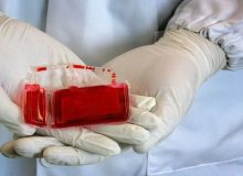 ۱۶۰۰ نمونه خون بند ناف در بانک سلول بنیادی ایلام ذخیره شد