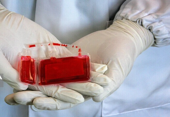 ۱۶۰۰ نمونه خون بند ناف در بانک سلول بنیادی ایلام ذخیره شد